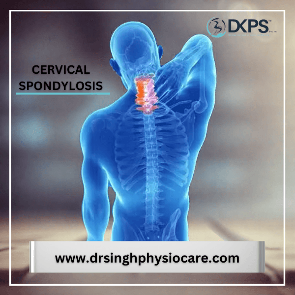 What is Cervical Spondylosis ?