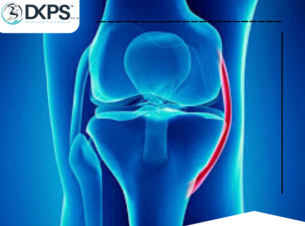 Medial Collateral Ligament(MCL)Injury