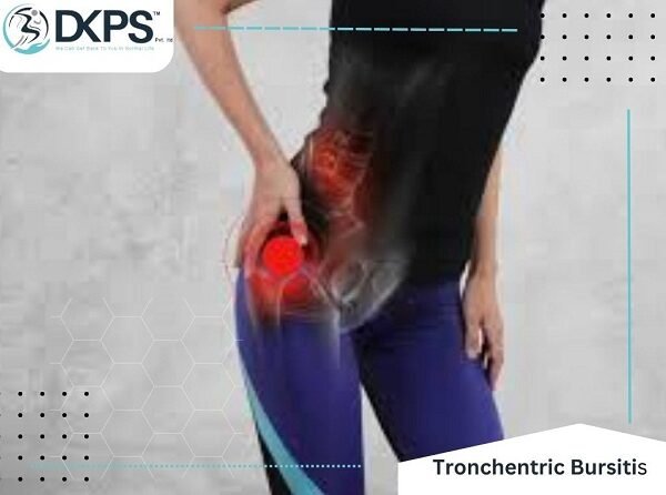 Trochanteric Bursitis