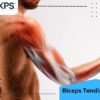 Biceps Tendinitis