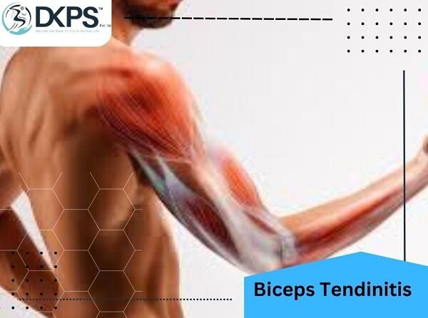 Biceps Tendinitis