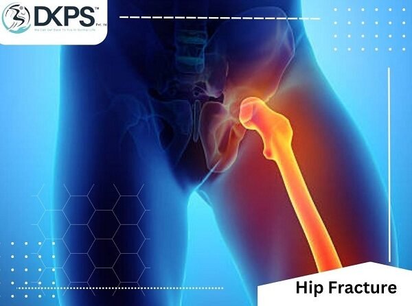 Hip Fracture