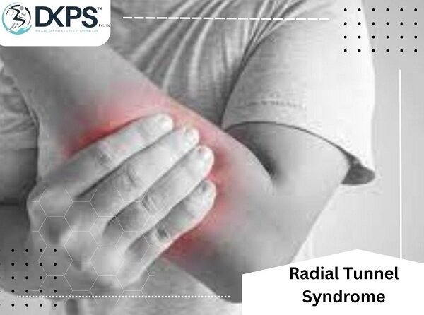 Radial Tunnel Syndrome