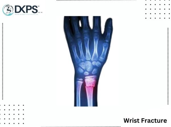 Wrist Fracture