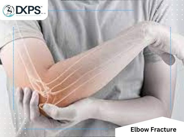 Elbow Fractures