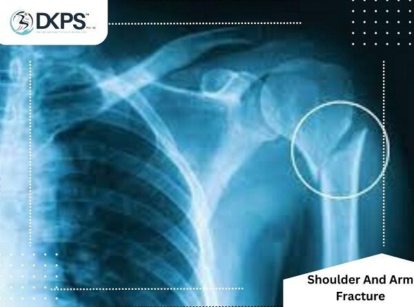 Shoulder And Arm Fractures