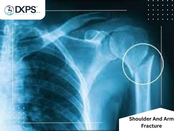Shoulder And Arm Fracture