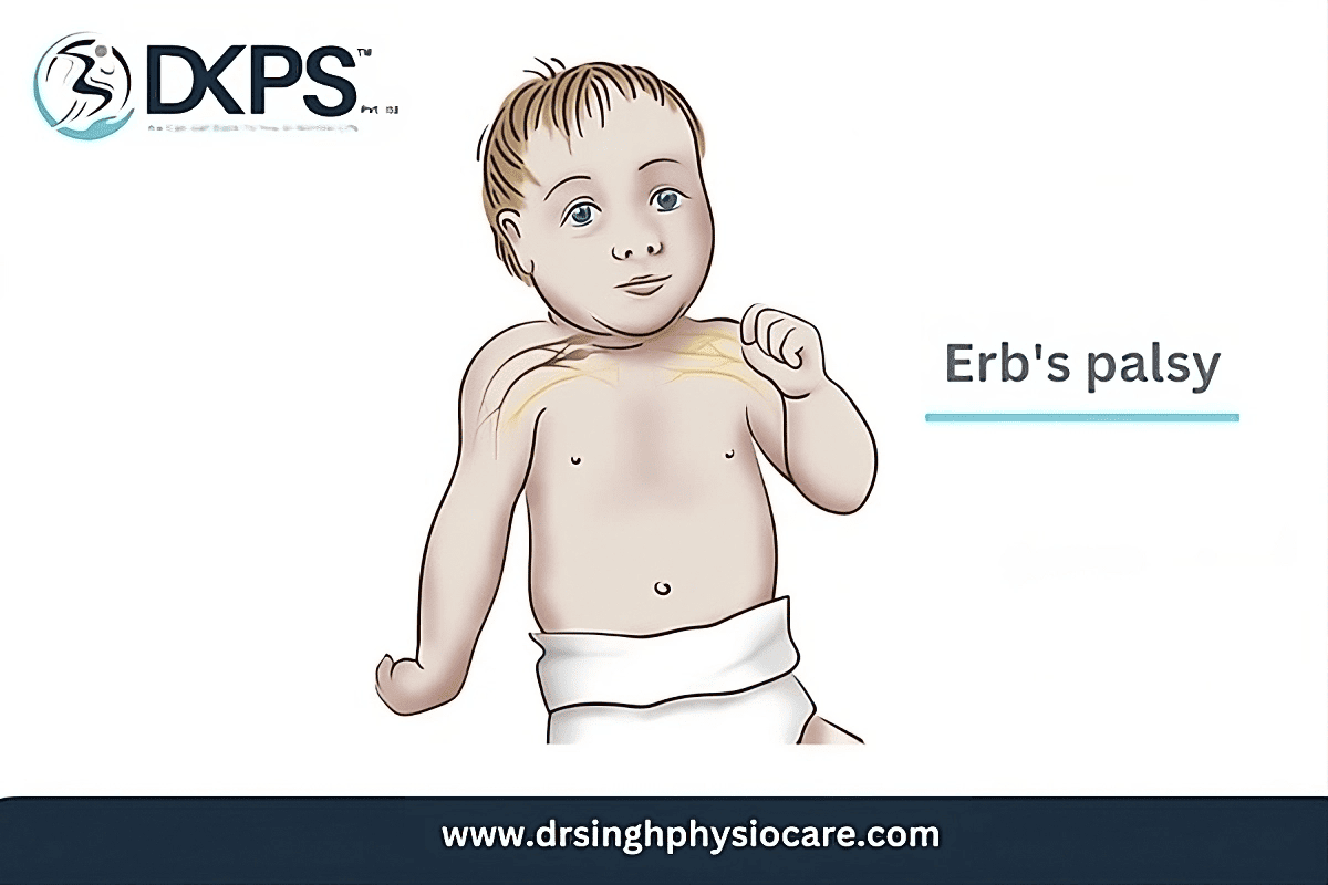 Erb's palsy: Symptoms, Causes & Treatment- DKPS Clinic