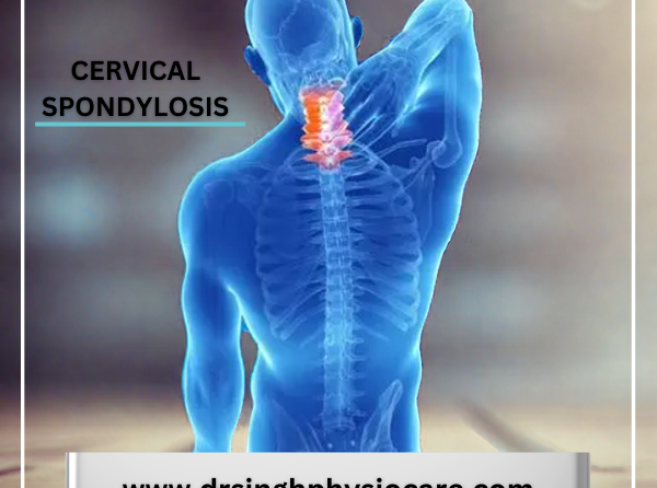 What is Cervical Spondylosis ?