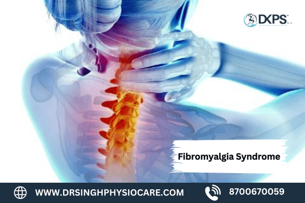 What is Fibromyalgia Syndrome ?